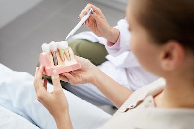 Woman holding a model of a dental implant, ashburn va