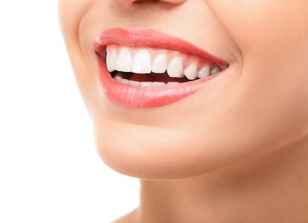 Woman with white teeth smiling, ashburn va