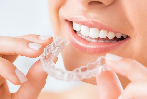 Woman with invisalign, ashburn va