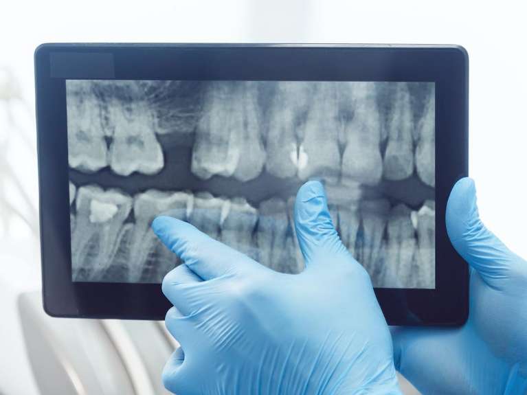 Digital x-rays on a tablet at posh smiles in ashburn va