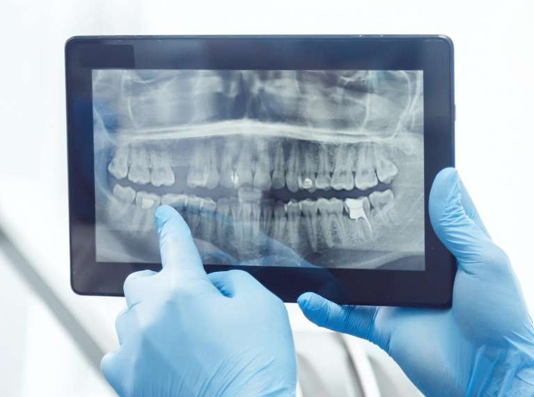 Panoramic X-Ray at posh smiles, ashburn va