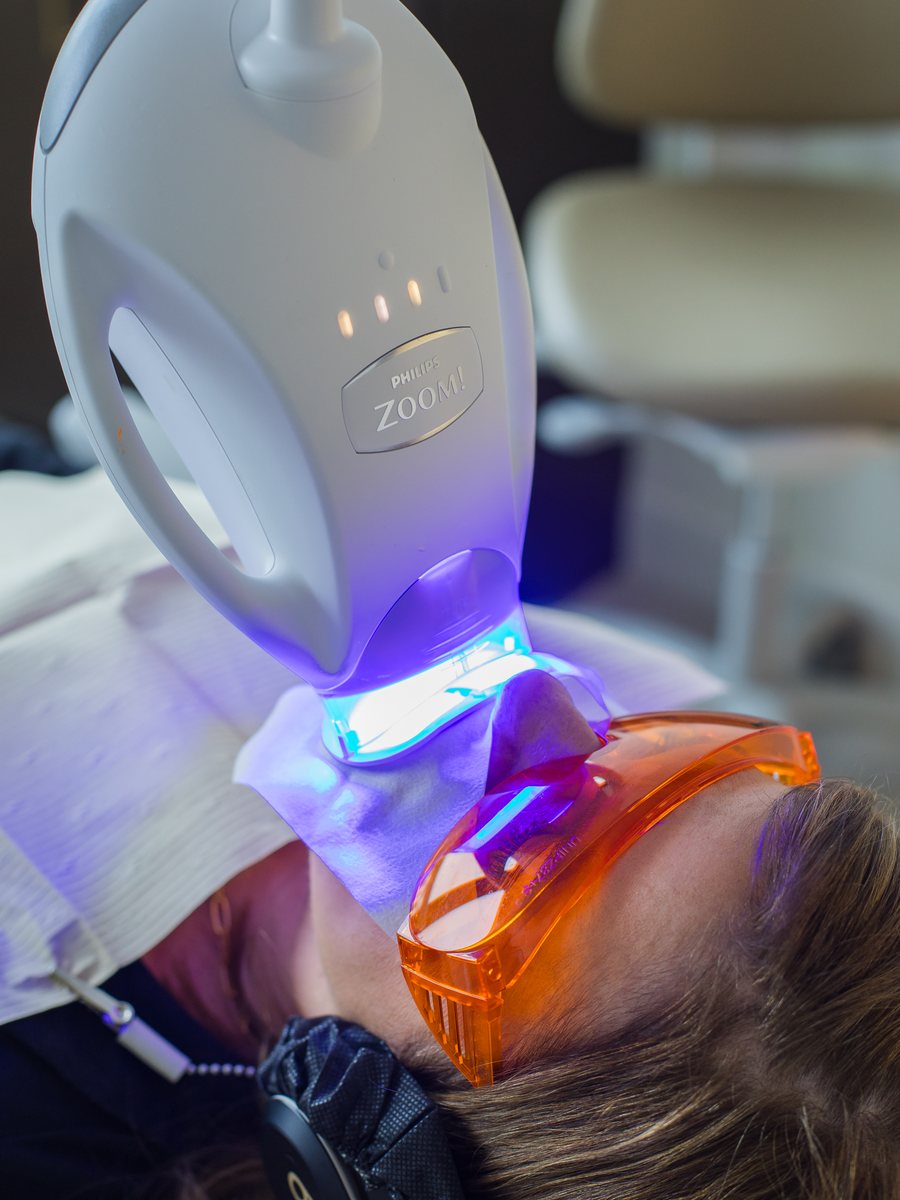 Philips Zoom whitening light activating the gel during an in-office teeth whitening treatment at POSH Smiles
